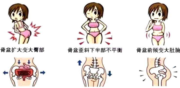 盆底肌修復(fù)，盆底肌康復(fù)治療怎么做這些問題較為常見