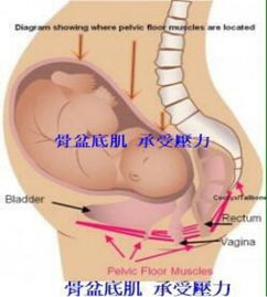 產(chǎn)后盆底康復(fù)治療開始后，出現(xiàn)陰道出血怎么破？
