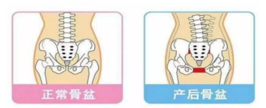 別大意！進(jìn)行產(chǎn)后修復(fù)項(xiàng)目，要選擇專業(yè)的產(chǎn)后修復(fù)中心